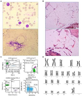 Rapid diagnosis of Aspergillus flavus infection in acute very severe aplastic anemia with metagenomic next-generation sequencing: a case report and literature review